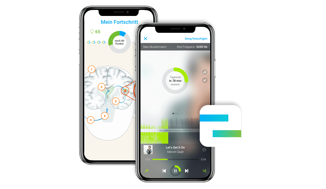 Tinnitus-Therapie via App